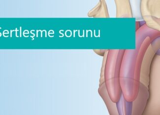 ED1000 ve ESWT Şok Dalga Tedavisi ile Sertleşme Sorunlarına Çözüm